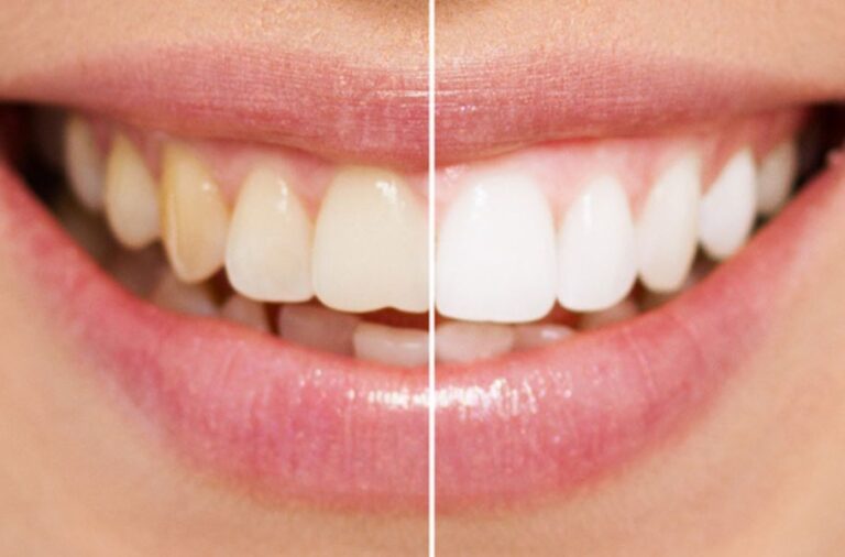 ghaznia khan - fortworthdentist.com